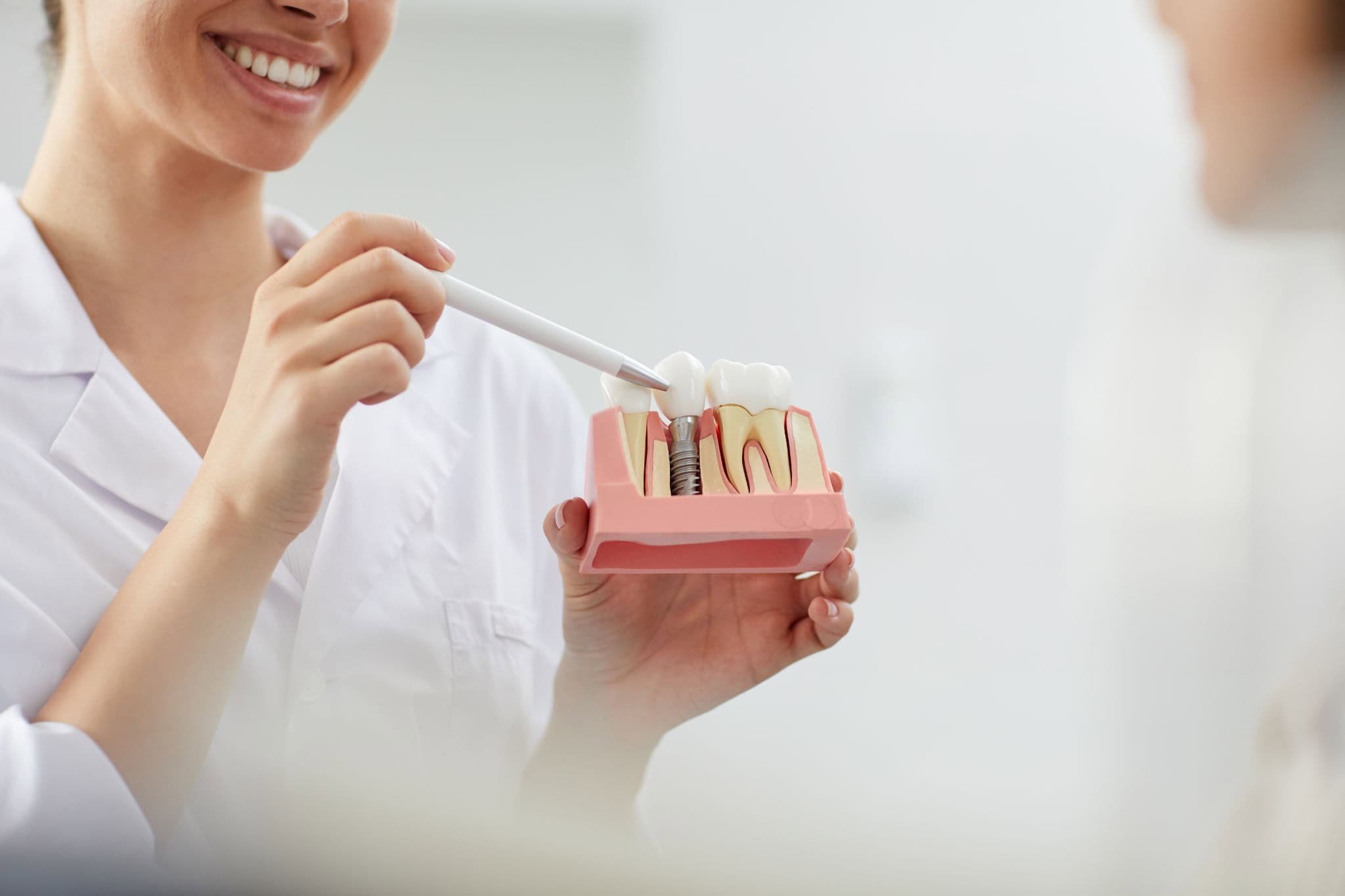 Implant dentar me protezë.