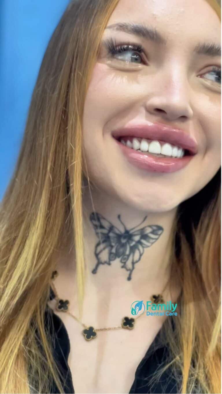 Sorriso di una giovane donna con denti bianchi e sani, in ambiente clinico.