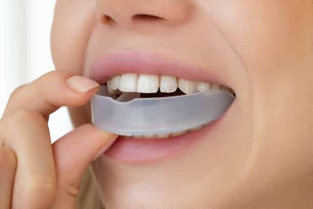 Bite protettivo in silicone per proteggere i denti durante sport o attività intense.