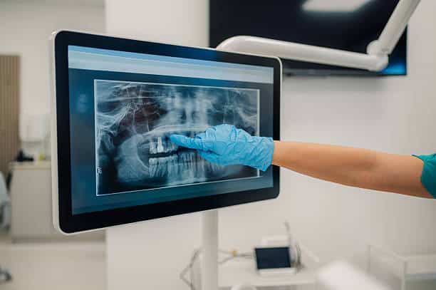 Immagine di un dentista che mostra una radiografia dentale su uno schermo digitale.