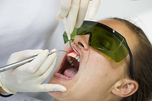 Trattamento di pulizia dentale professionale con strumenti odontoiatrici.