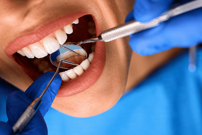 Dentista esamina i denti di una paziente con strumenti odontoiatrici.